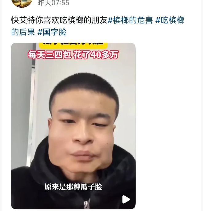 年成方块脸吃了40多万网友都不敢信！K8凯发天生赢家太吓人！小伙吃槟榔8(图6)