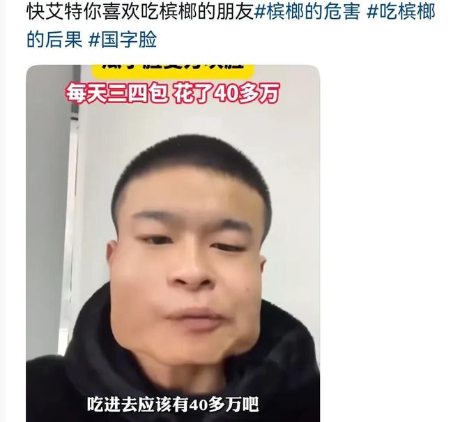年成方块脸吃了40多万网友都不敢信！K8凯发天生赢家太吓人！小伙吃槟榔8(图7)